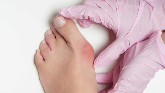 Zašto nastaju čukljevi i kako ih ispraviti?