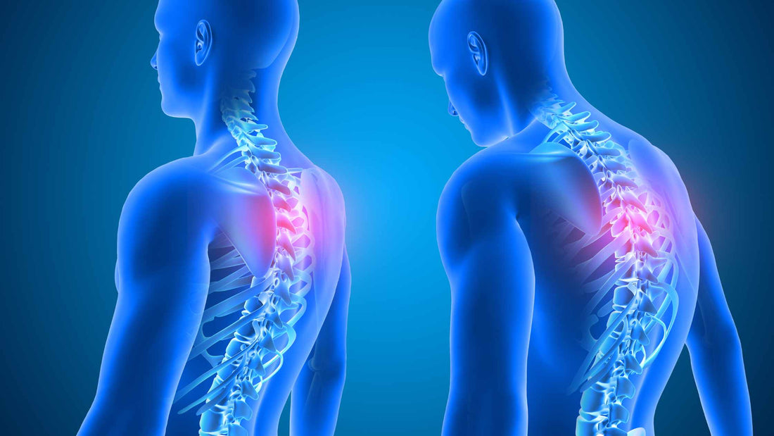 Imate krivu kičmu? Ne možete da ispravite leđa? - utvrđivanje problema i rešenja