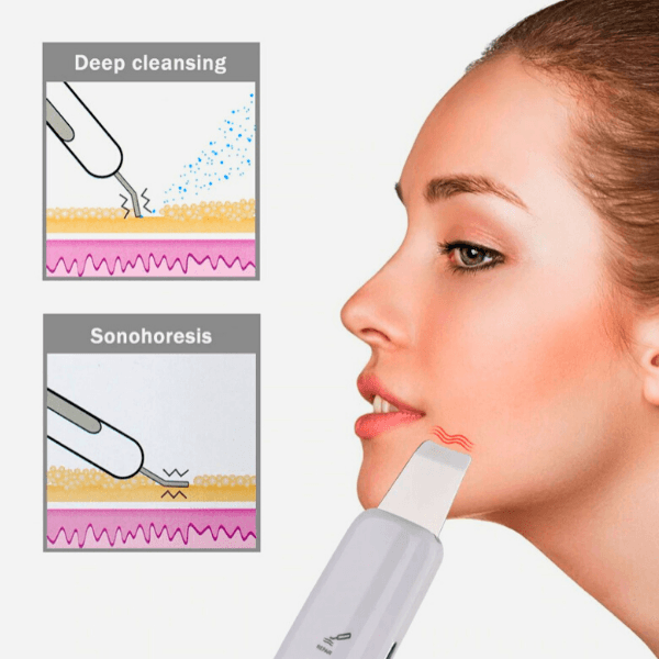 Profesionalni uređaj za čišćenje lica