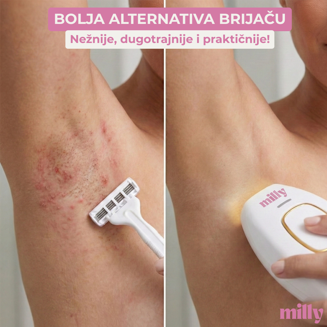 MILLY Epilator SkinShine®