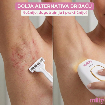 MILLY Epilator SkinShine®