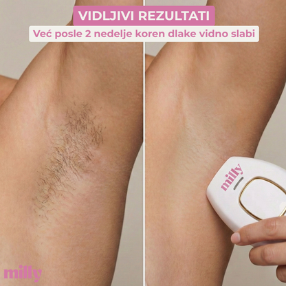 MILLY Epilator SkinShine®
