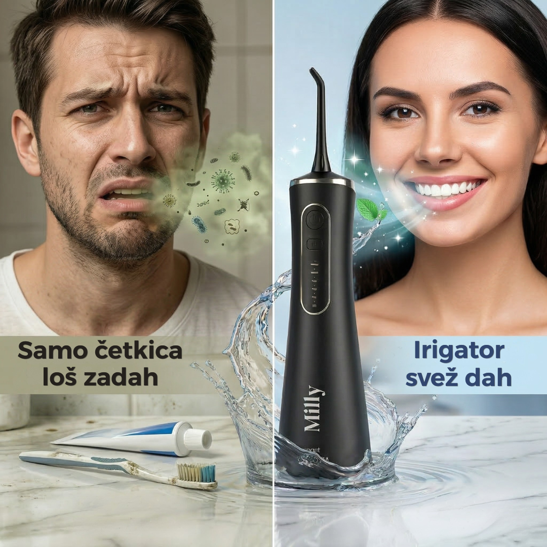 Milly irigator za zube